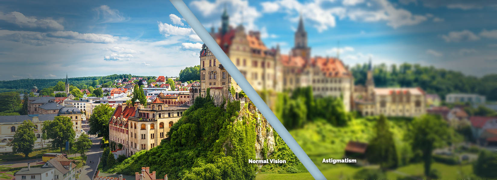 Astigmatism Treatment in Gardner