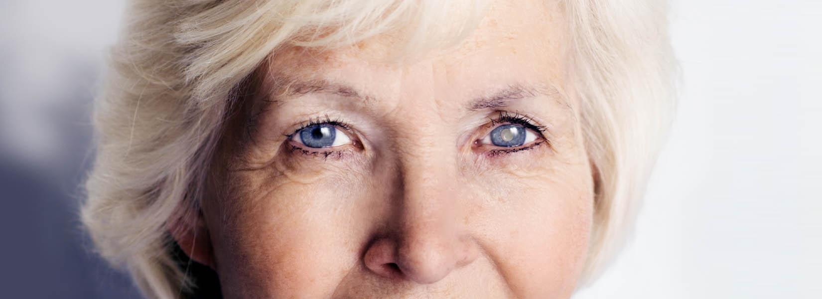 Cataract Surgery in Gardner