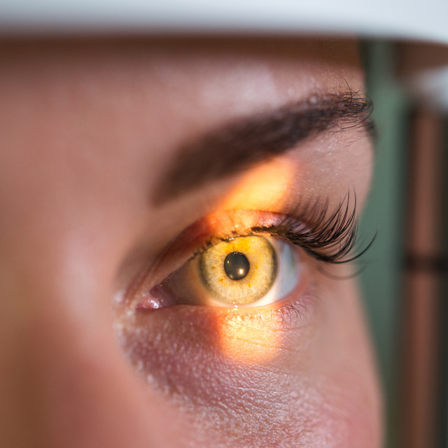 Vision Therapy in Gardner